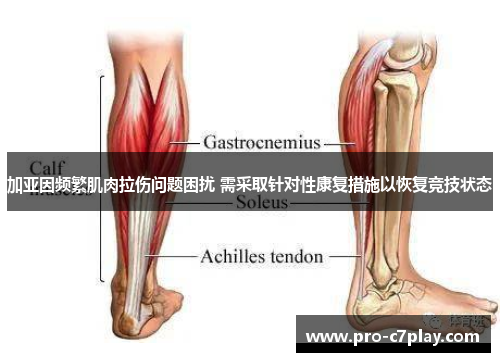 加亚因频繁肌肉拉伤问题困扰 需采取针对性康复措施以恢复竞技状态